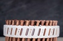 lignoloc-mit-kopf-coil-magazinierung.jpg